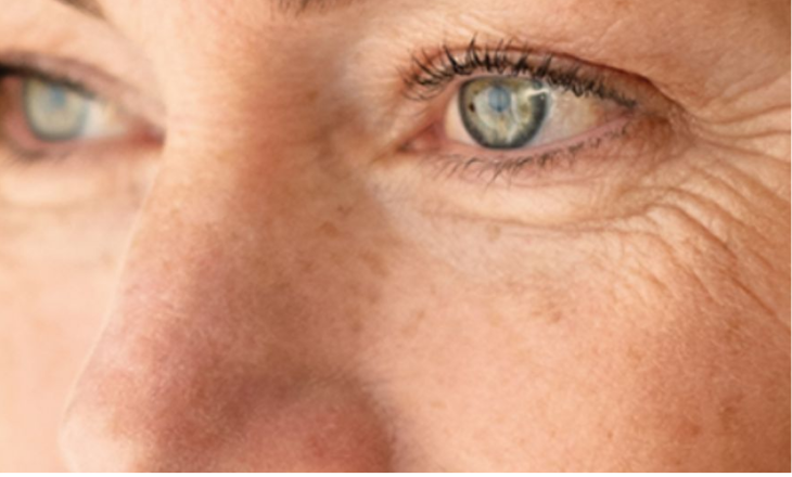 Rides et ridules
Venus Versa™ Pro lisse rides, raffermit la peau et stimule le collagène sans chirurgie invasive.
En savoir plus